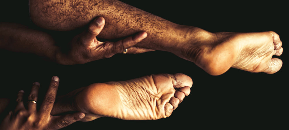 Sex Positions for Broken Ankle